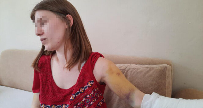 Beyzbol sopasıyla öldüresiye dövülen genç kadın: ‘Öleceğimi sandım’