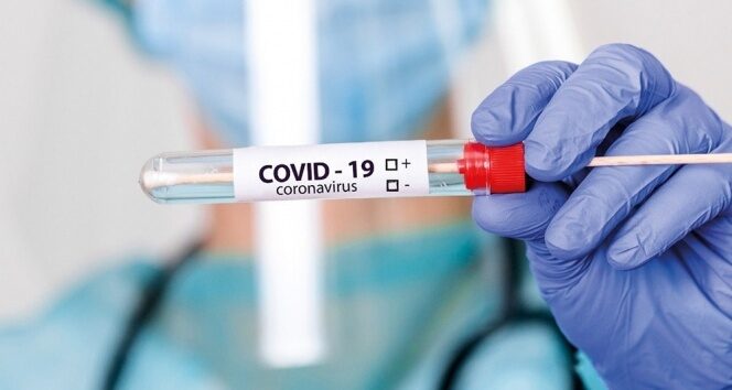 Türkiye’de son 24 saatte 6.493 koronavirüs vakası tespit edildi