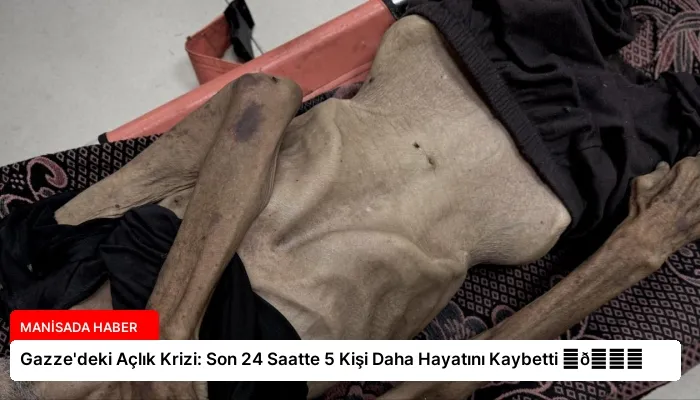 Gazze’deki Açlık Krizi: Son 24 Saatte 5 Kişi Daha Hayatını Kaybetti ⏬👇